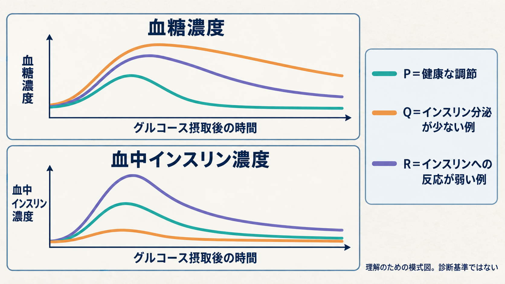 グルコース摂取後の血糖濃度とインスリン濃度の模式的な変化を、健康な調節、インスリン分泌が少ない場合、インスリンへの反応が弱い場合で比較した図