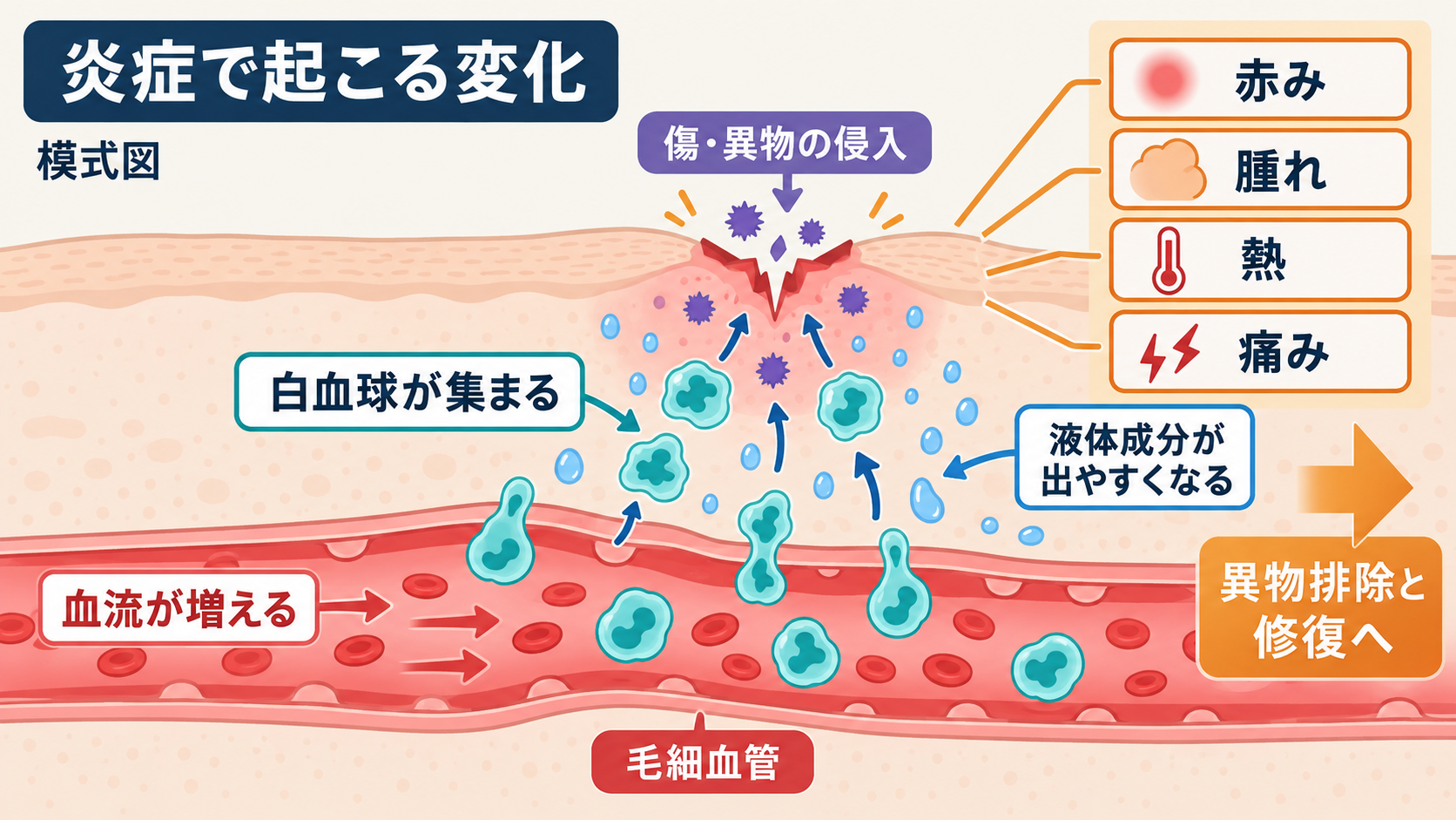 組織に病原体が侵入すると血管の反応が起こり、白血球や液体が侵入部位へ移動する炎症の模式図